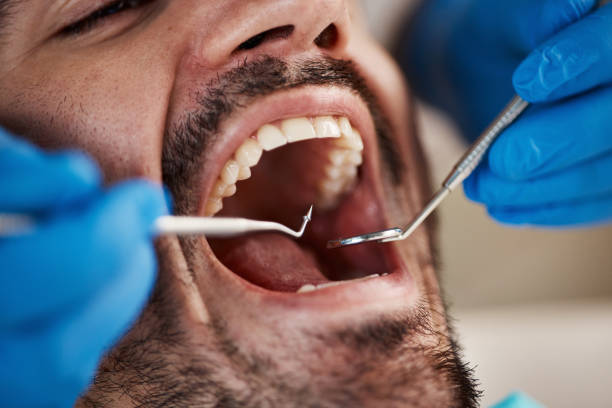 Best Emergency Treatment for Oral Infections in South Shore, KY